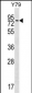MAK Antibody (C-term)